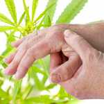 Cannabis e artrite