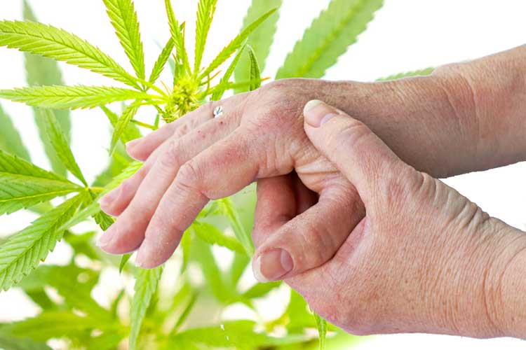 Cannabis e artrite