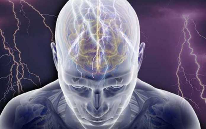 cannabis-epilessia2 Illustrazione dei centri colpiti da epilessia
