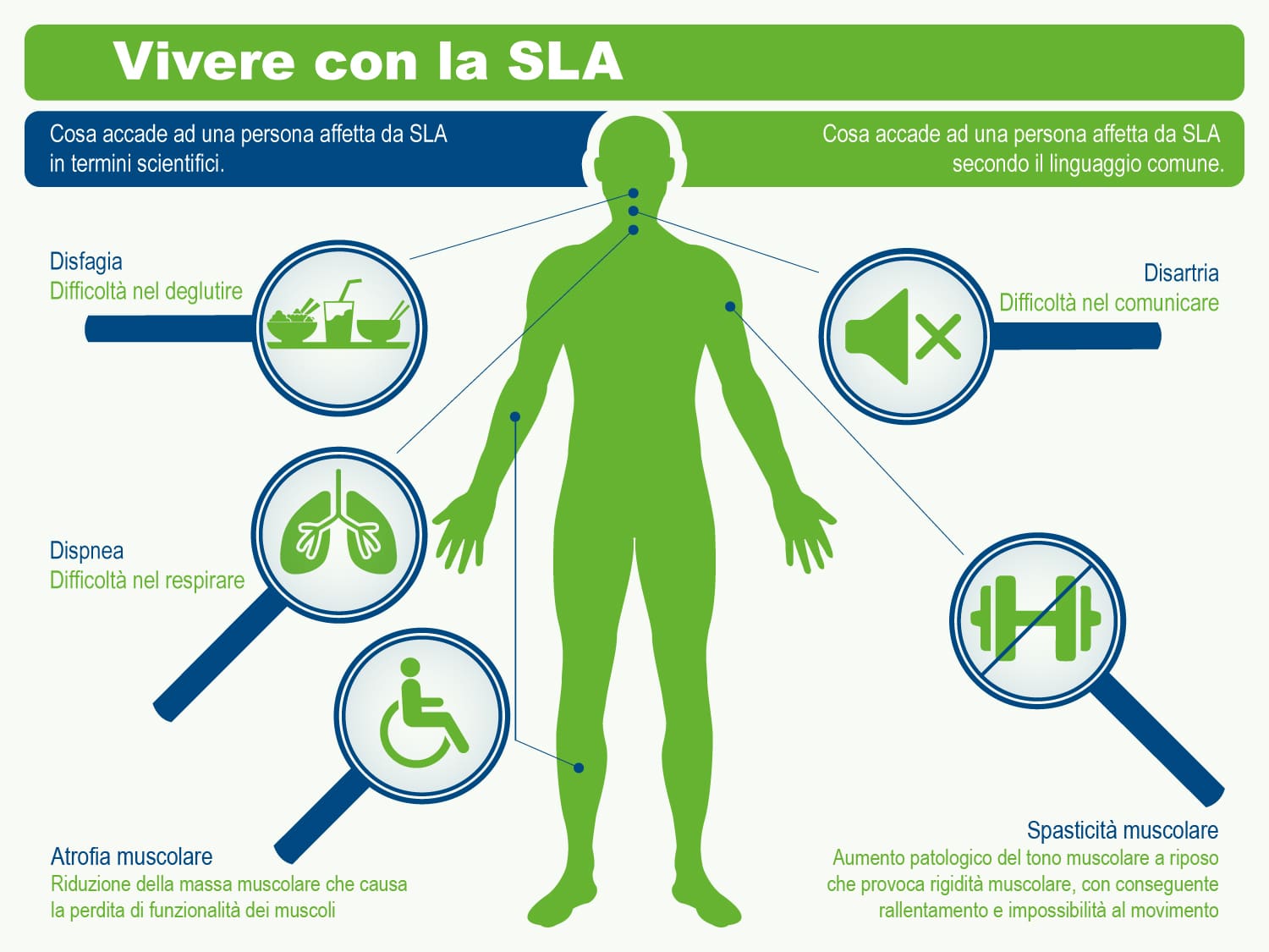 Descrizione della SLA